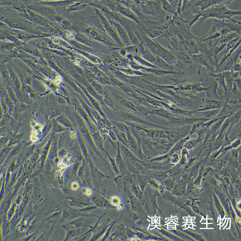 HSF（人皮肤成纤维细胞）
