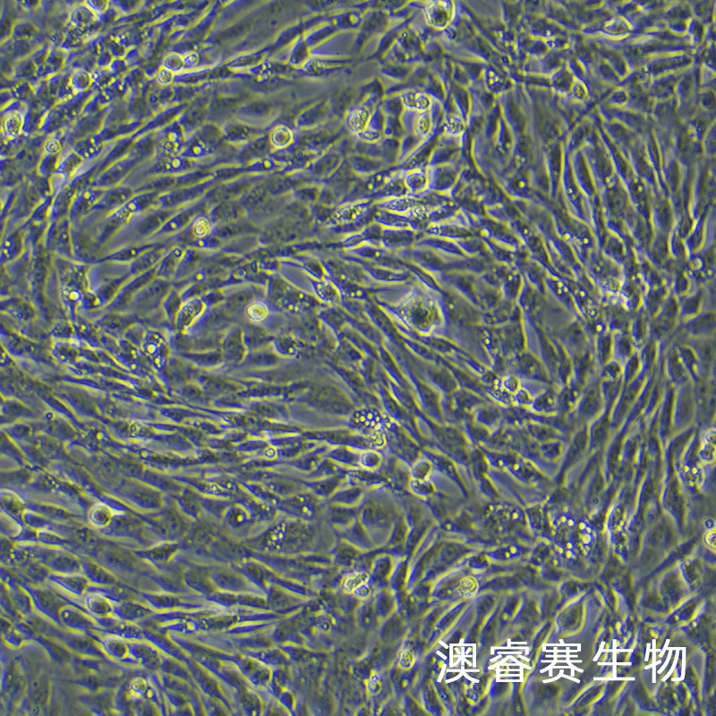 HDF-a（人真皮成纤维母细胞-新生 HDF-n）