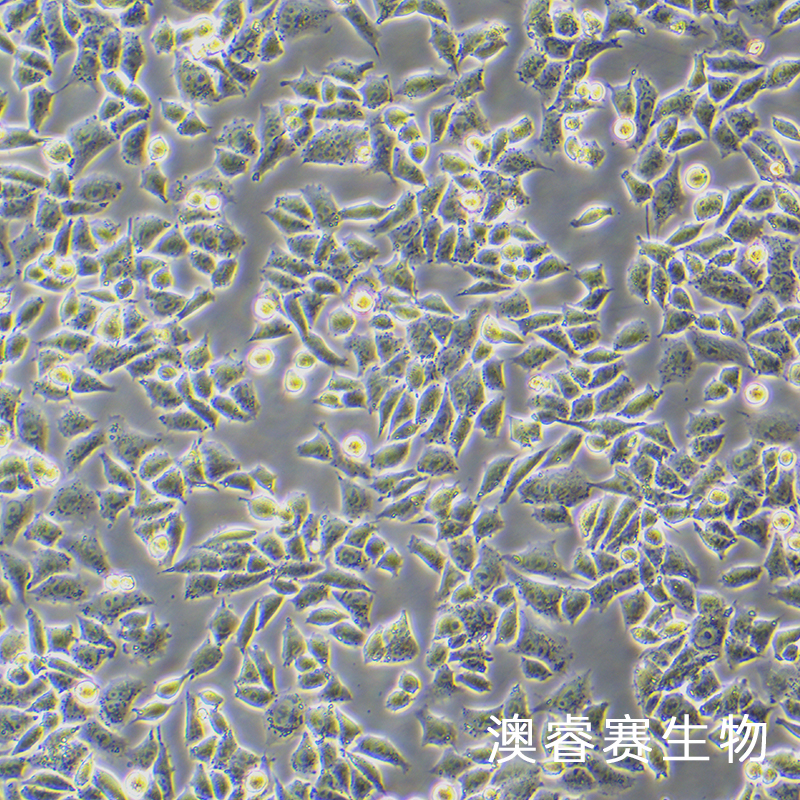 A2780（人卵巢癌细胞）