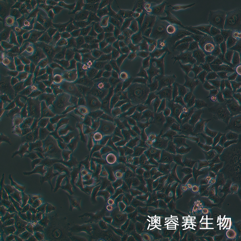CNE（人鼻咽癌细胞）