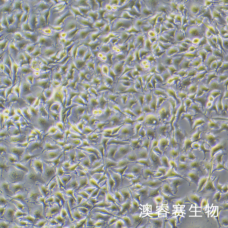 B16-F0（小鼠黑色素瘤细胞）