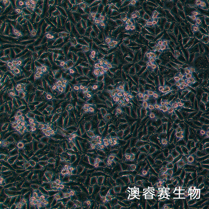 PATU8988T（人胰腺癌细胞）