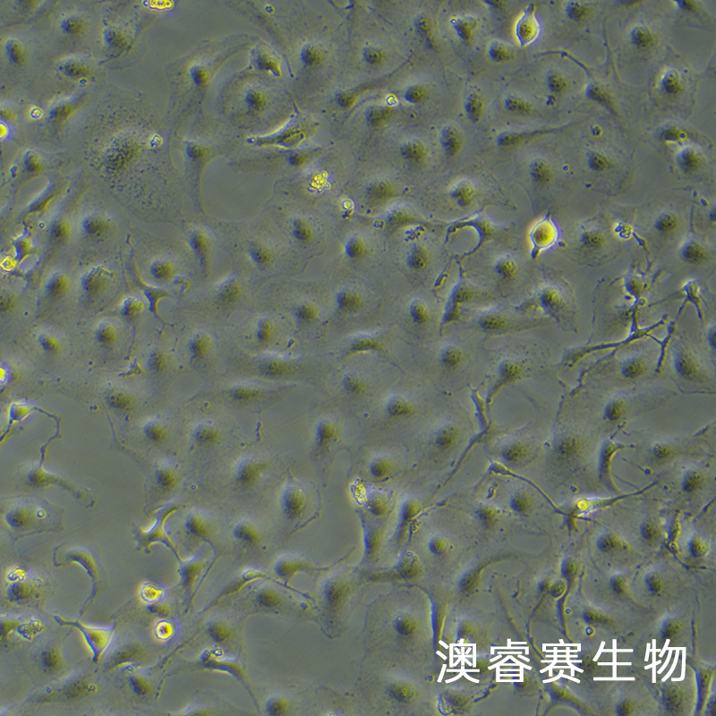 LX-2（人肝星形细胞）