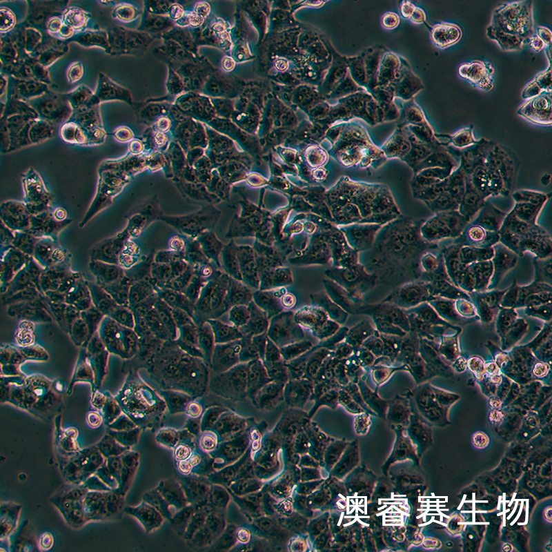MHCC97-L（人低转移肝癌细胞）