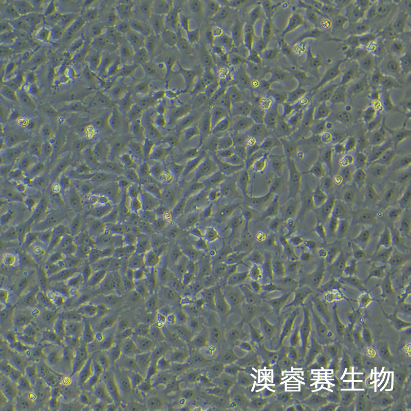 Mv.1.Lu [NBL-7; Mv1Lu]（貂肺上皮细胞）