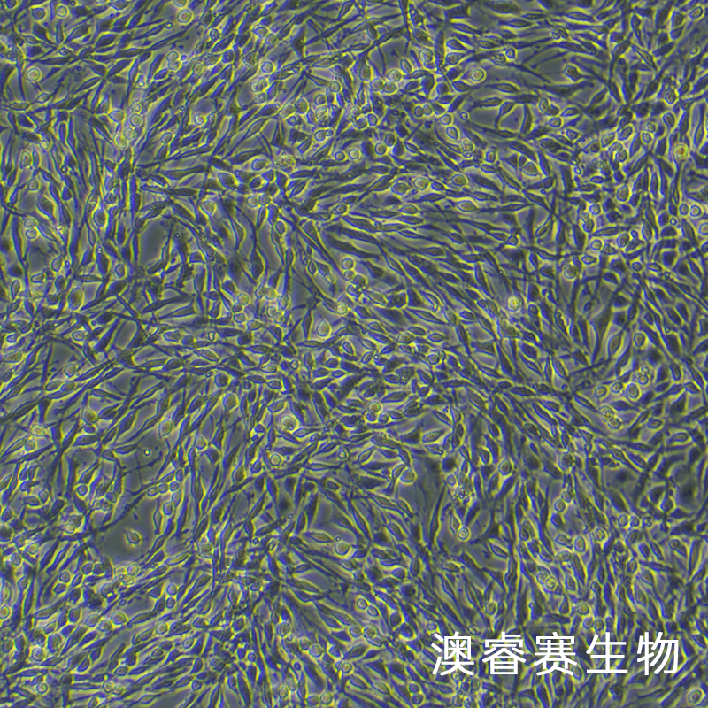 PC-12高分化（大鼠肾上腺嗜铬细胞瘤细胞（高分化））