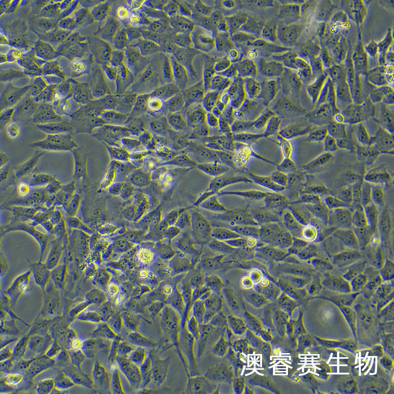 WPMY-1（人正常前列腺基质永生化细胞）
