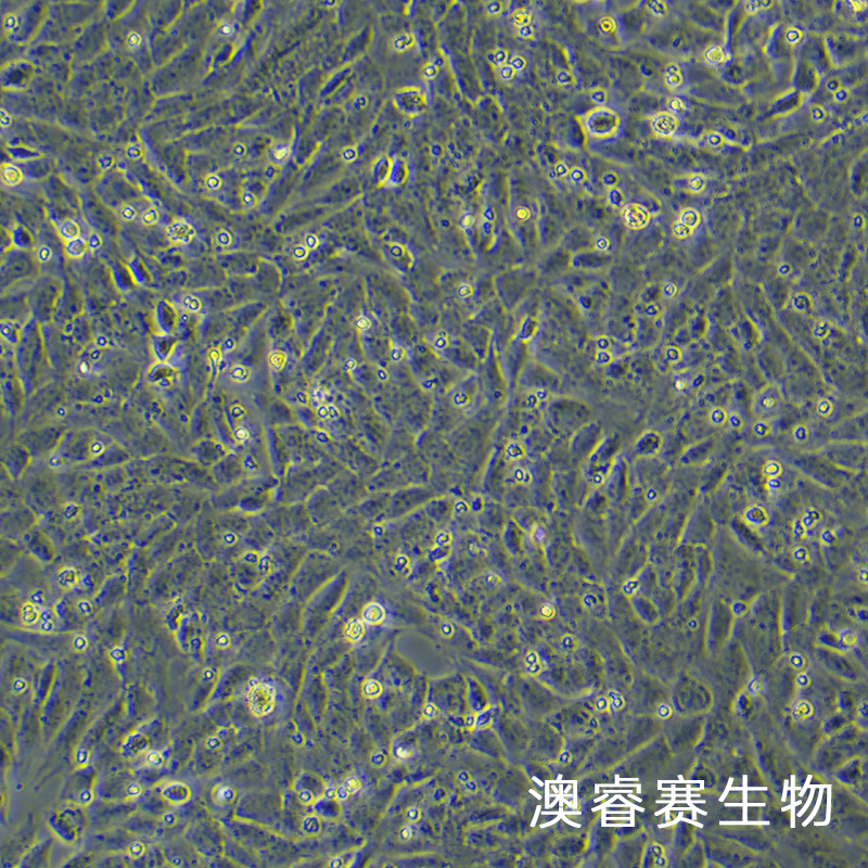UMR-106（大鼠骨肉瘤细胞）