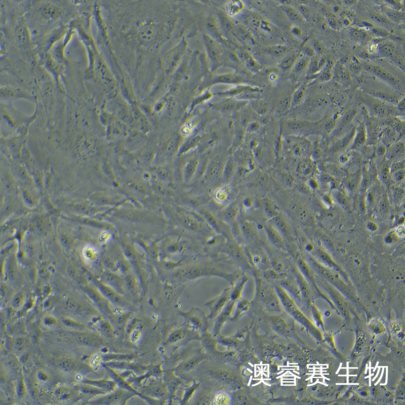 SW 1353（人软骨肉瘤细胞）