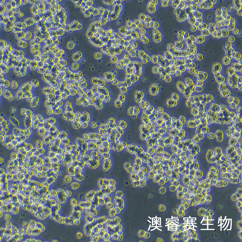 SK-NEP-1（人肾母细胞瘤细胞）