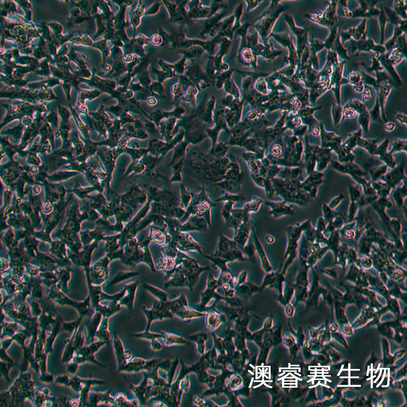 SK-N-BE2（人神经母细胞瘤细胞）