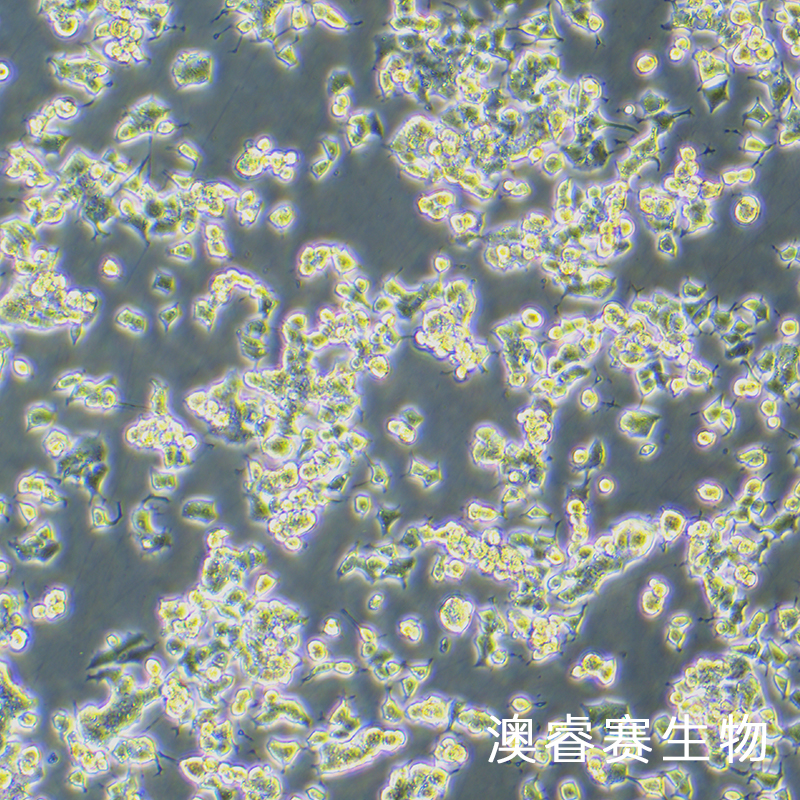 PC-12未分化（大鼠肾上腺嗜铬细胞瘤细胞（未分化））