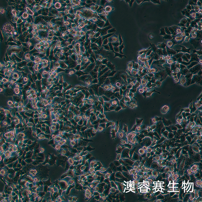 NCI-H520（人肺鳞癌细胞）