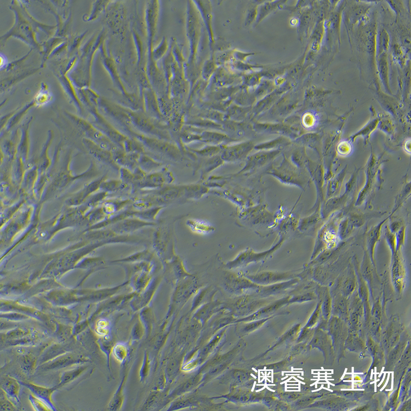 hFOB 1.19（人SV40转染成骨细胞）