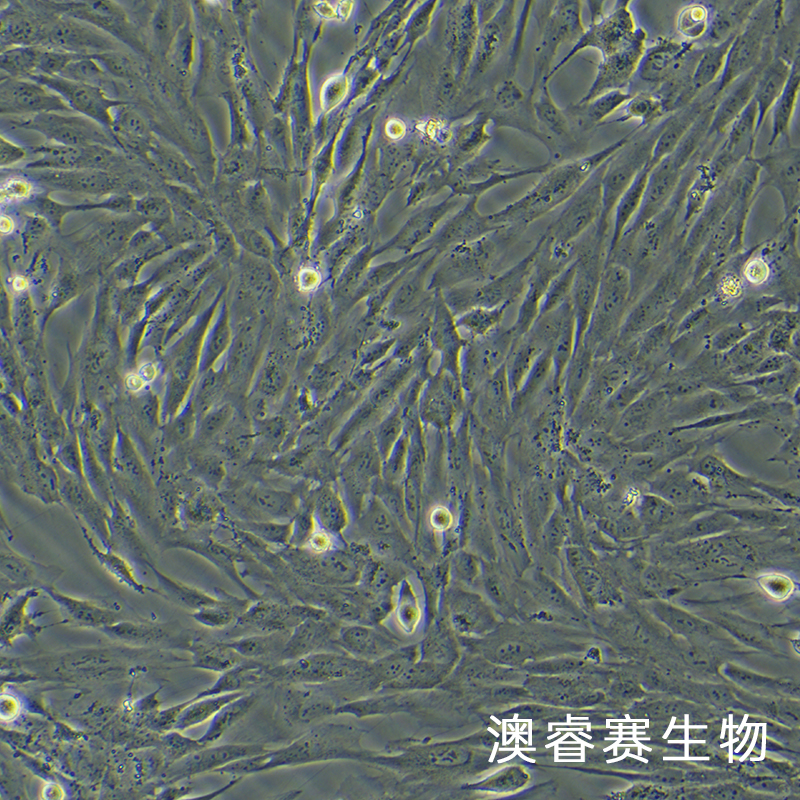 hFOB 1.19（人SV40转染成骨细胞）