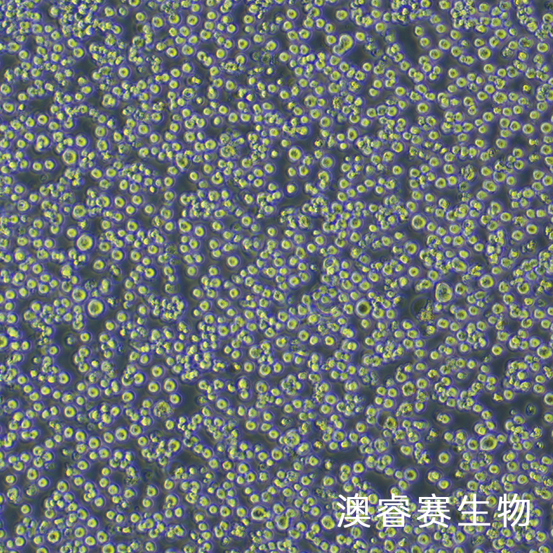 H22（小鼠肝癌细胞）