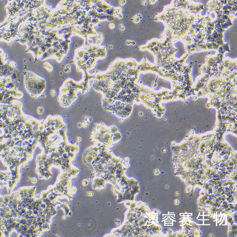 BETA-TC-6（小鼠胰岛素瘤胰岛β细胞）