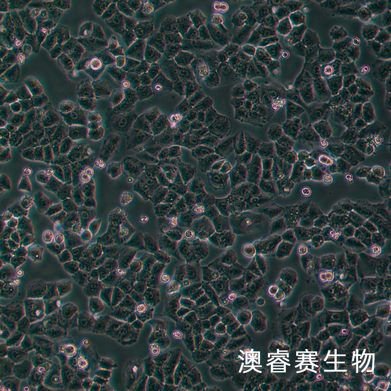 NCI-H460 [H460]（人大细胞肺癌细胞）