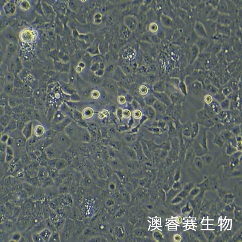 Ishikawa（人子宫内膜癌细胞）