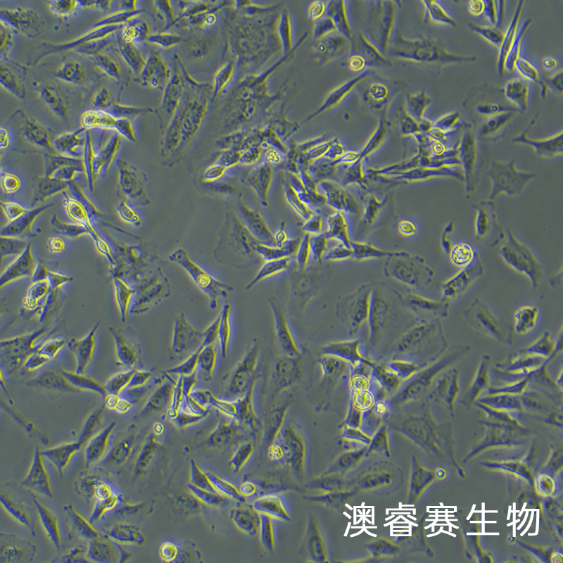 U-87 MG（人脑星形胶质母细胞瘤细胞）