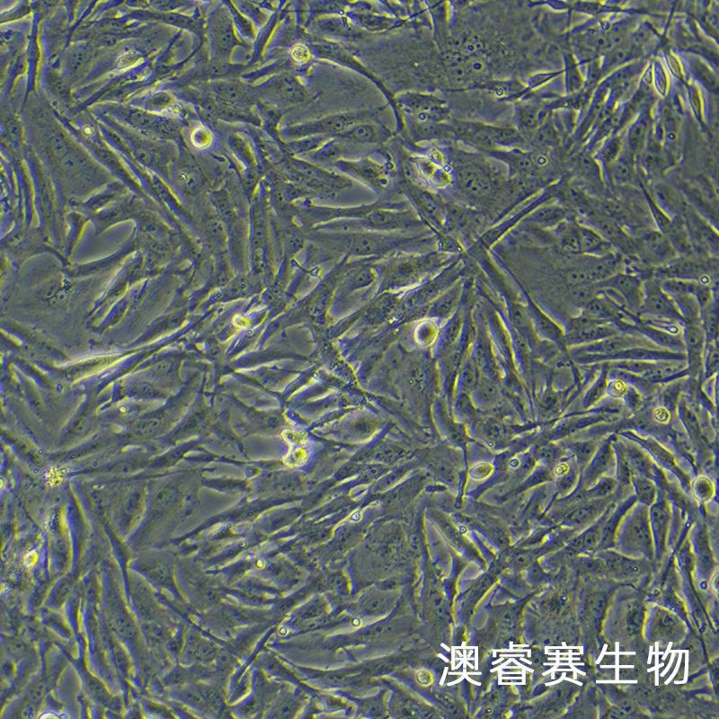 U251（人胶质瘤细胞）