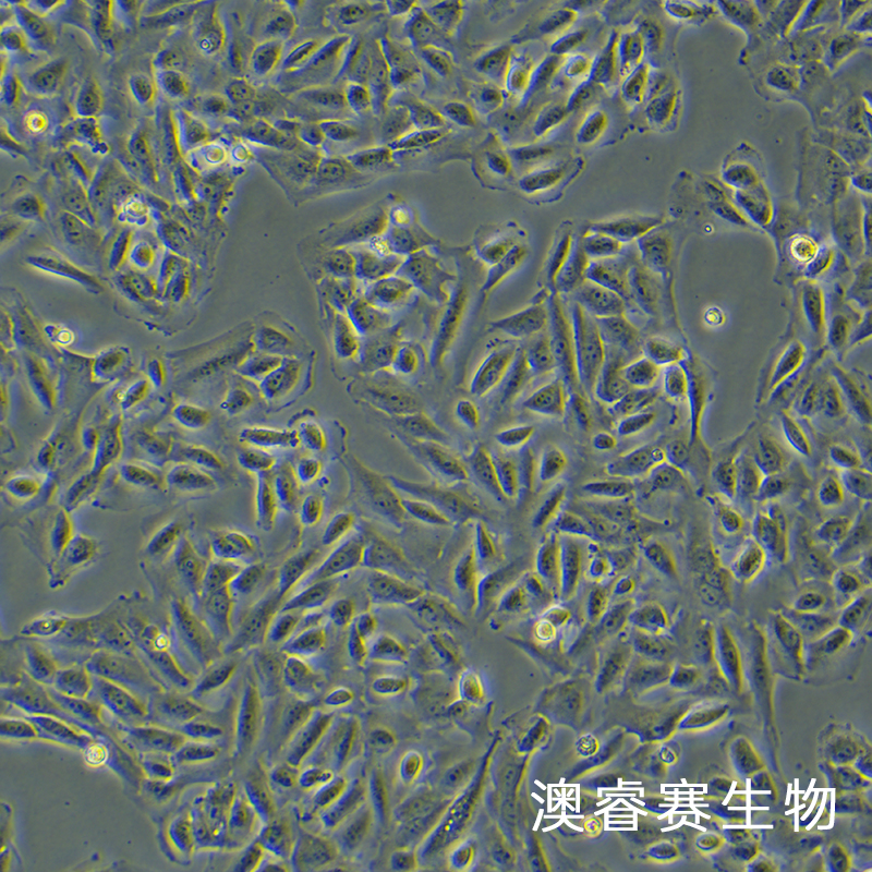T24 [T-24]（人膀胱移行细胞癌细胞）