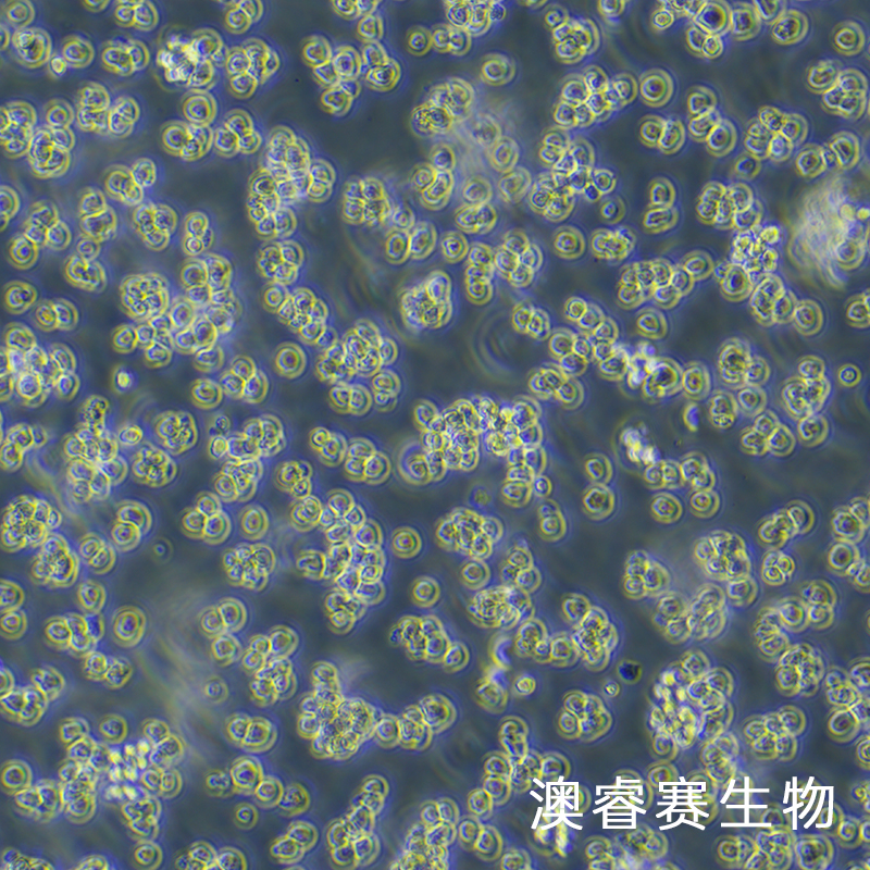 SP2/0（小鼠骨髓瘤细胞）
