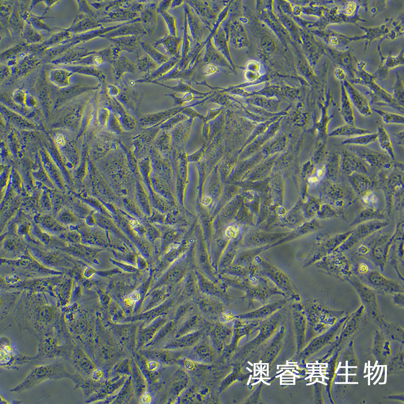 Saos-2（人成骨肉瘤细胞）