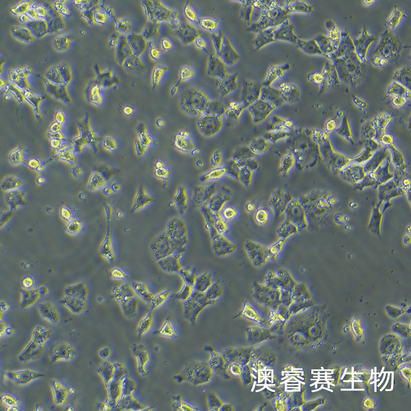 RH-35（大鼠肝癌细胞）