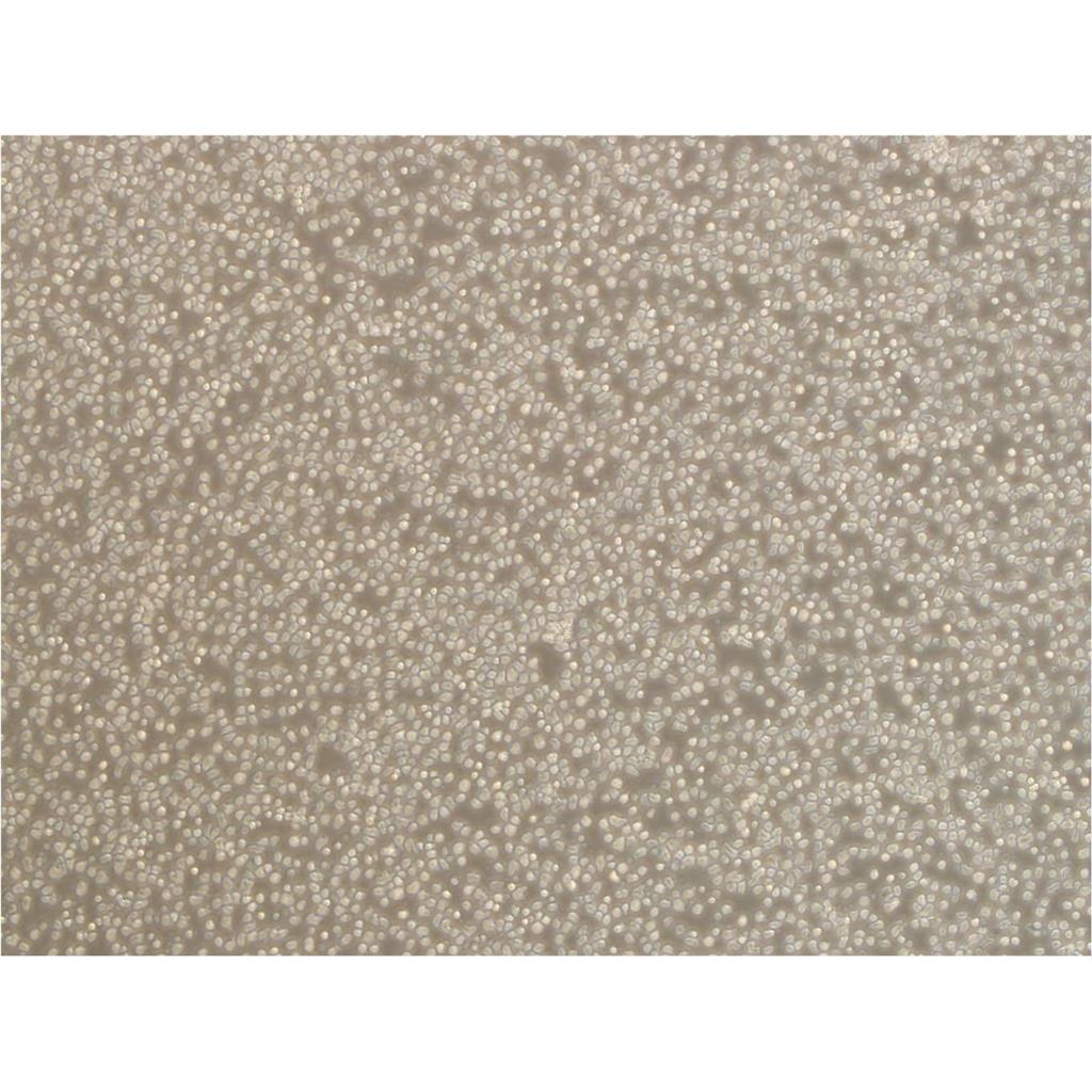 HEL Cells人红白细胞白血病细胞种子库代次低