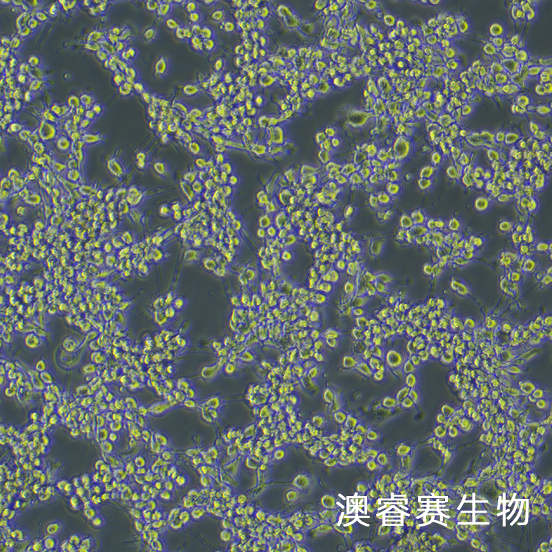 MFC（小鼠胃癌细胞）