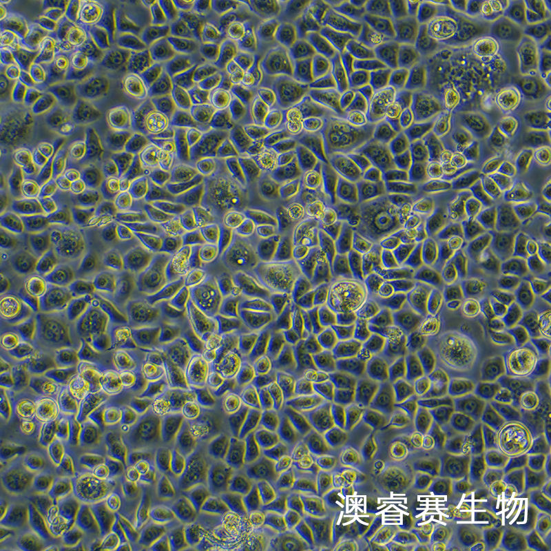 ME-180（人子宫颈表皮癌细胞）