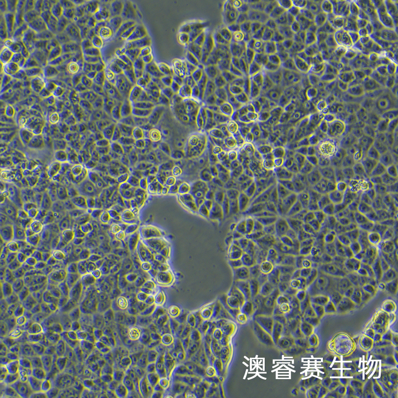 MCF7 [MCF-7]（人乳腺癌细胞）