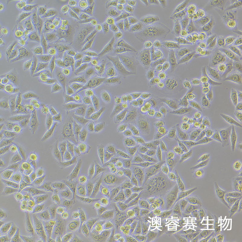 MADB106（大鼠乳腺癌细胞）