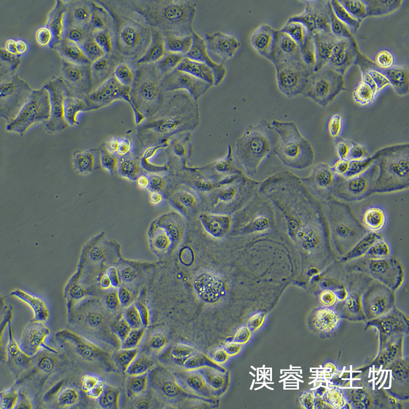 KLE（人子宫内膜癌细胞）