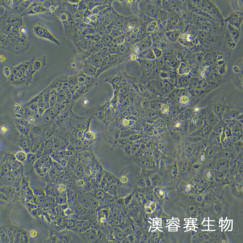 JEG-3（人绒毛膜癌细胞）