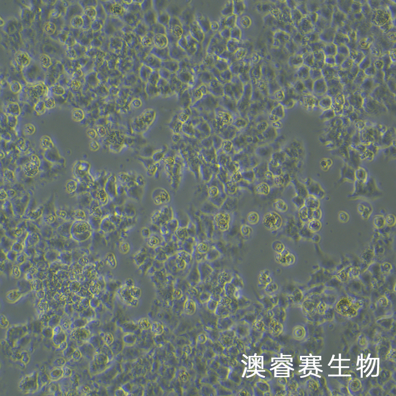 JAR（人胎盘绒毛癌细胞）