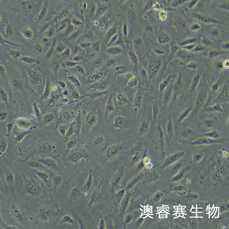 HUV-EC-C [HUVEC]（人脐静脉血管内皮细胞）