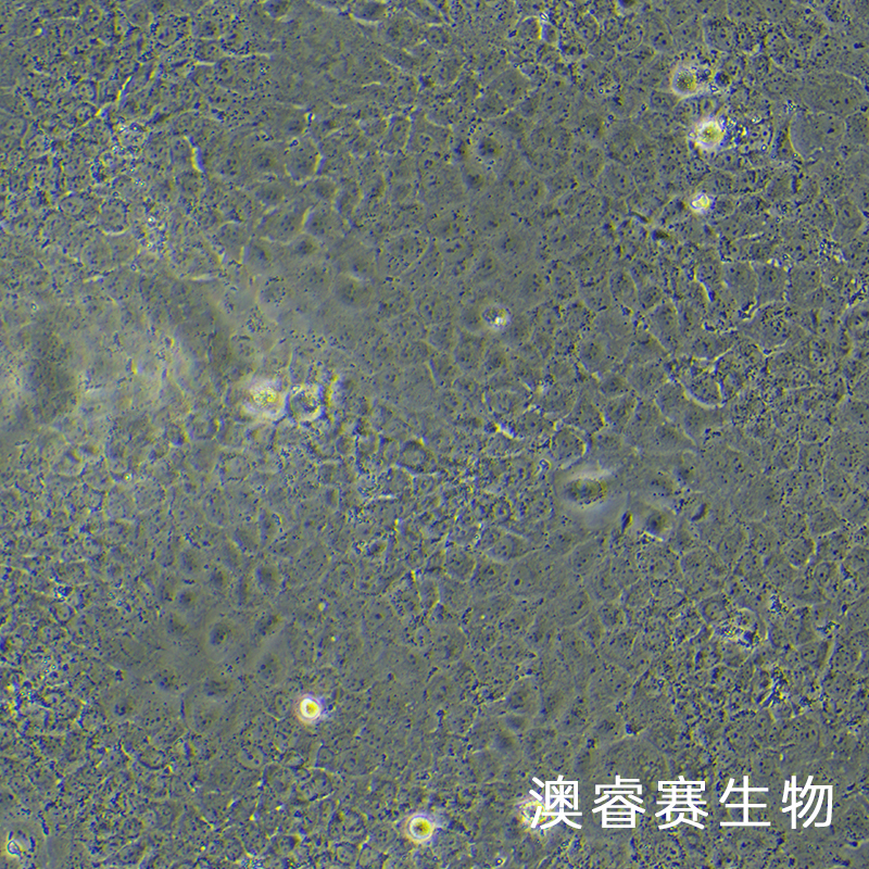 HuH-7（人肝癌细胞）