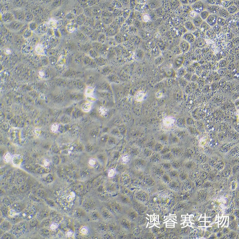 HuH-6（人肝母细胞瘤细胞）