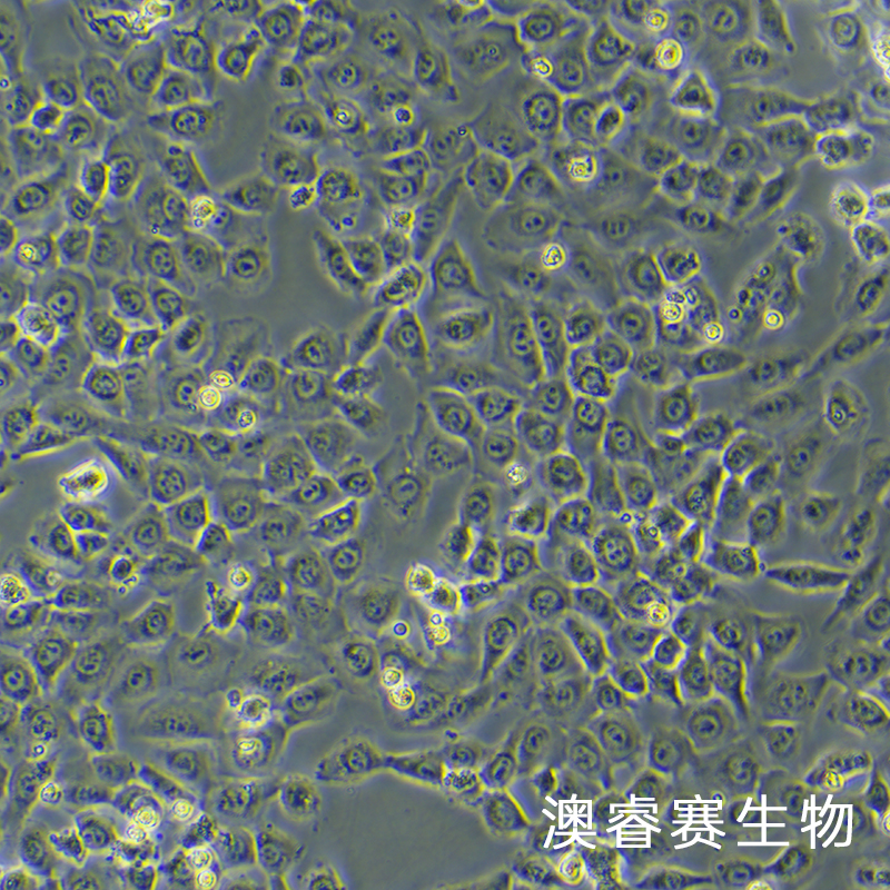 HT-1080 [HT1080]（人纤维肉瘤细胞）