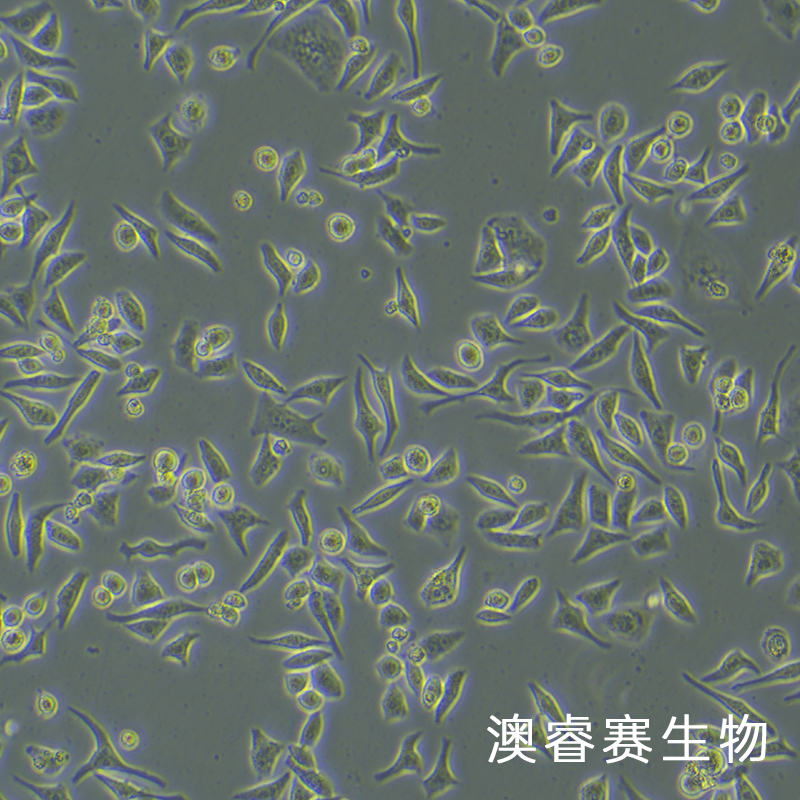 Hela（人宫颈癌细胞）