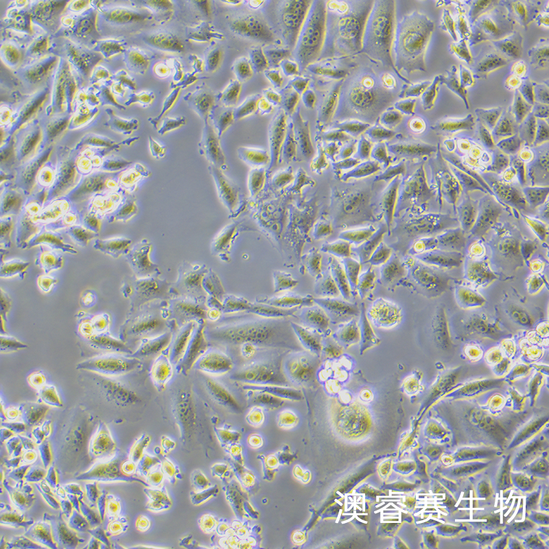 CHO-K1（仓鼠卵巢细胞亚株）