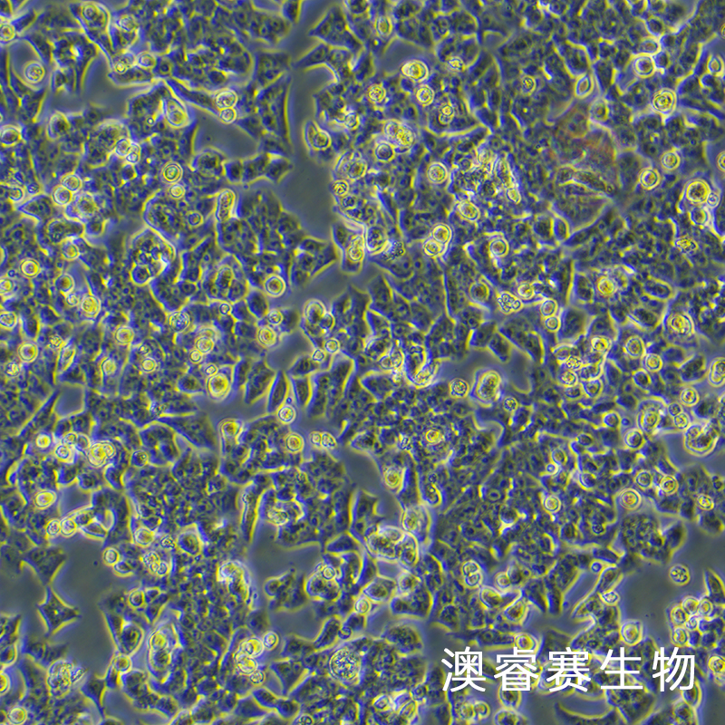 BIU-87（人膀胱癌细胞）