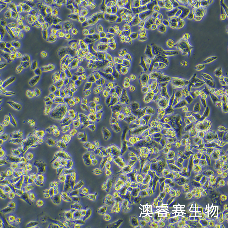 AsPC-1（人转移胰腺腺癌细胞）