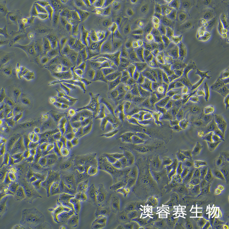 A549 [A-549]（人非小细胞肺癌细胞）
