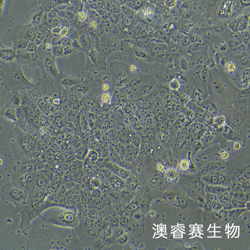 A-431（人表皮癌细胞）