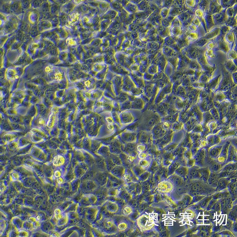 95-D（人高转移肺癌细胞）