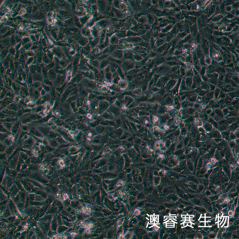 769-P（人肾细胞腺癌细胞）