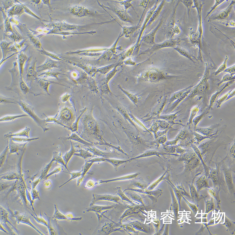 3T3-L1（小鼠胚胎成纤维细胞）